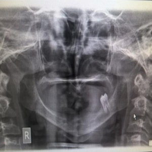 oral manifestations